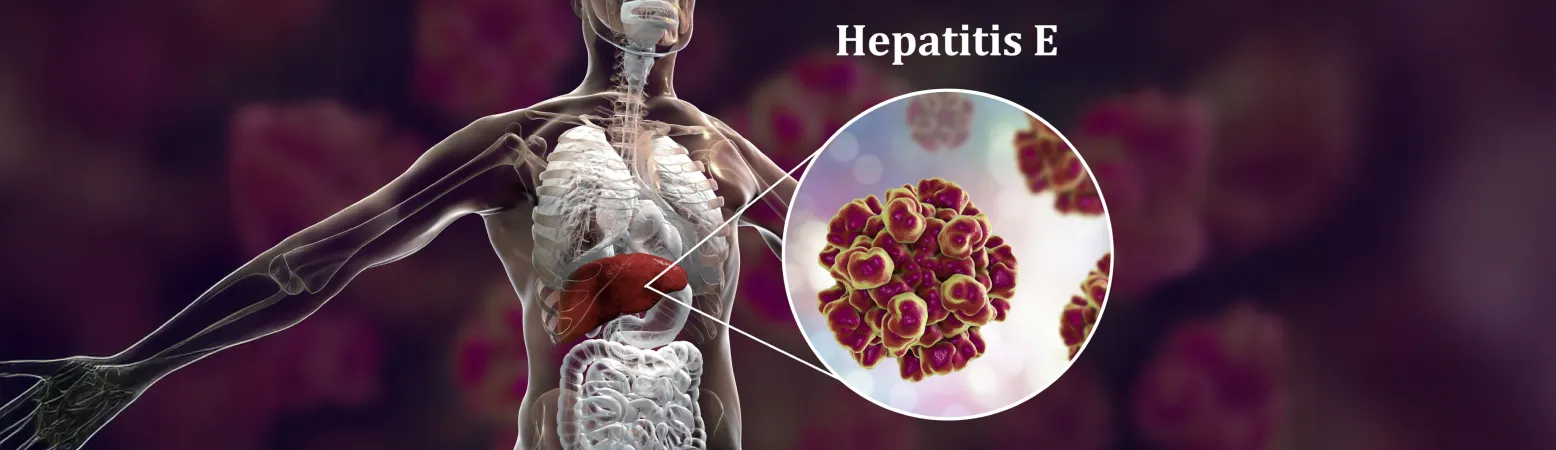 Hepatitis-E-Virus vor Lebergrafik: Virusinfektionen nehmen zu – was für Leber und Gesundheit wichtig ist